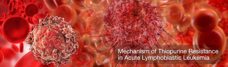 Mechanism of Thiopurine Resistance in Acute Lymphoblastic Leukemia