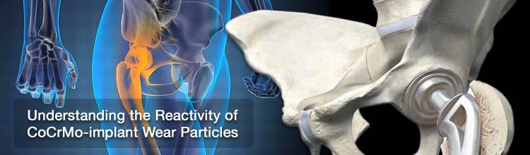 Understanding the Reactivity of CoCrMo-implant Wear Particles