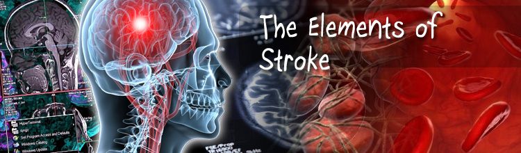 The Elements of Stroke