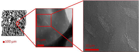 Figure 1 Micro-CT (left) shows trabecular structure inside of bone. Transmission X-ray microscopy (TXM; center and right) can reveal localized details of osteocyte lacunae and their processes.