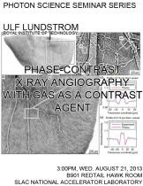 Phase-contrast X-ray angiography with gas as a contrast agent