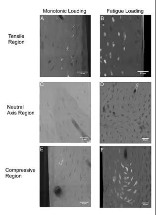 Cortical Bone Figure 1