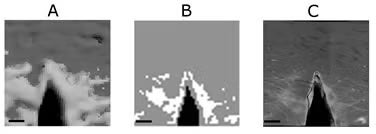 Cortical Bone Figure 2